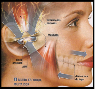 O que é ATM? - Ápex Odontologia