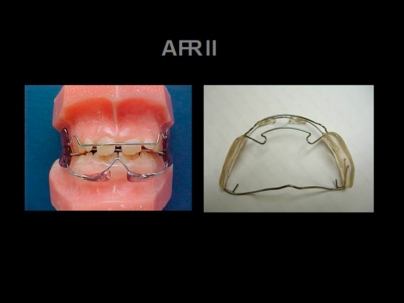 Tratamento ATM – Ortomix Odontologia